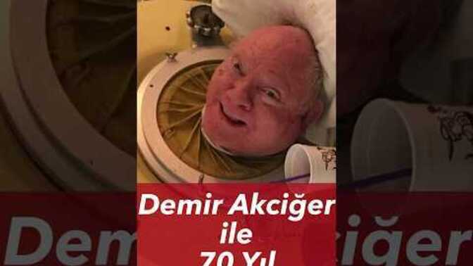 Demir akciğer içinde 70 yıl yaşamak nasıl bir şeydi, o dönemde hayat nasıldı?