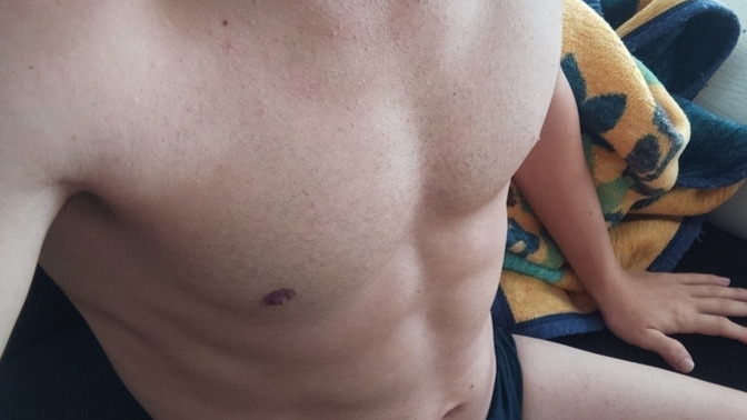 Soğukta bile üstsüz yatma isteği neden geliyor, normal mi yoksa bir sorun mu var?