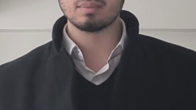 Burun estetiği sonrası 2 aydır geçmeyen yamukluk normal mi, zamanla düzelir mi?