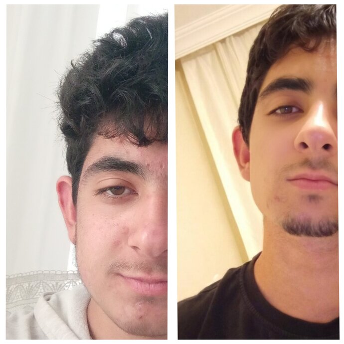 2 aylık glow up etkili olmuş mu?