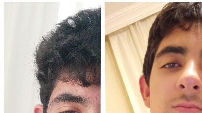 2 aylık glow up etkili olmuş mu?