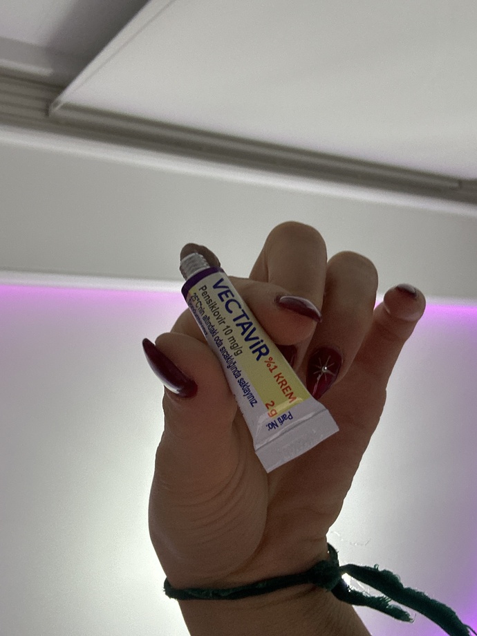 Uçuk kremi 300₺ye aldim niye bu kadar küçük sjsjsjsjjs?