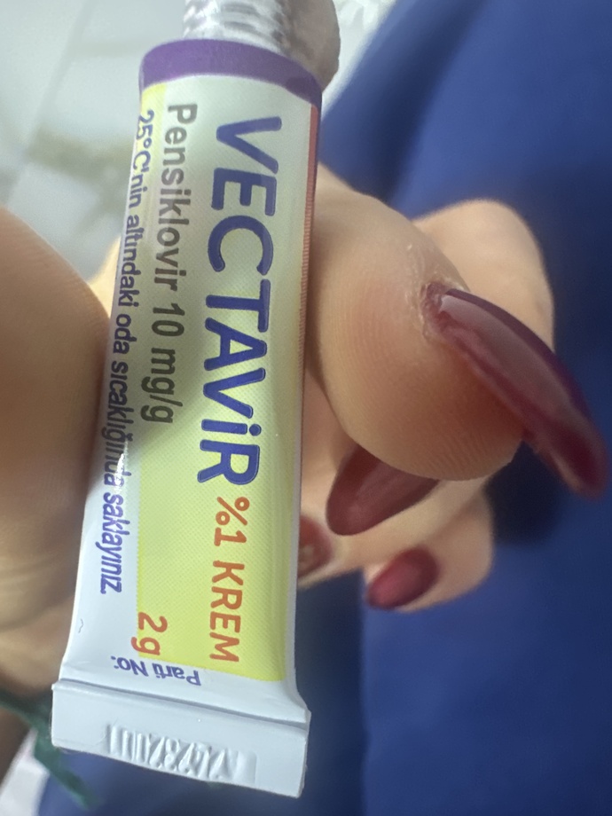 Uçuk kremi 300₺ye aldim niye bu kadar küçük sjsjsjsjjs?