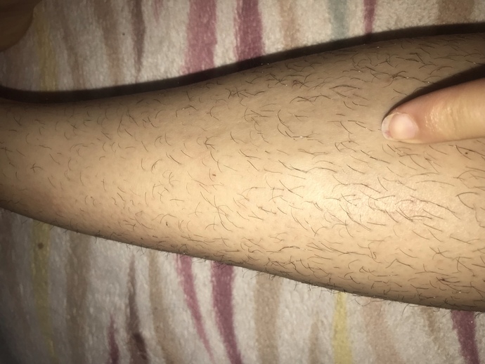 Şu sorunu nasıl halledebilirim tavsiye?