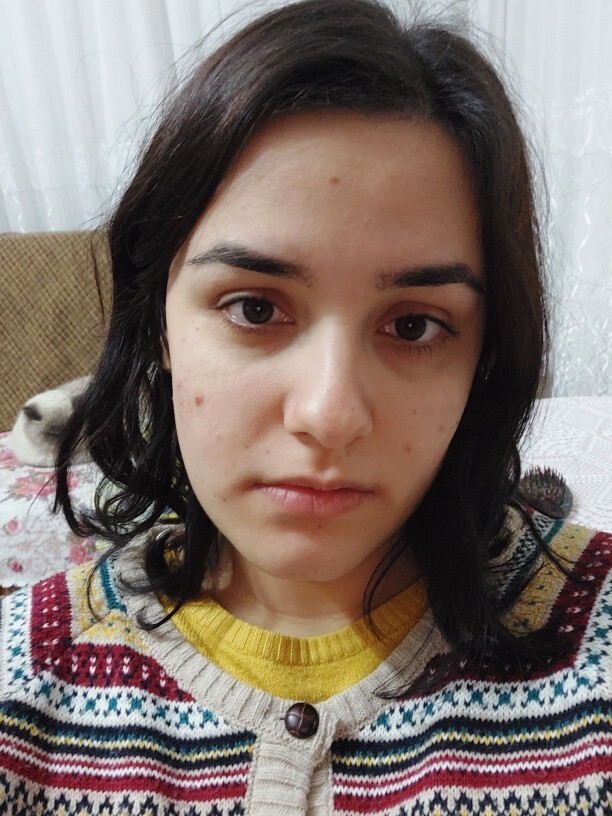 Kaşlarım beni delirtcek?