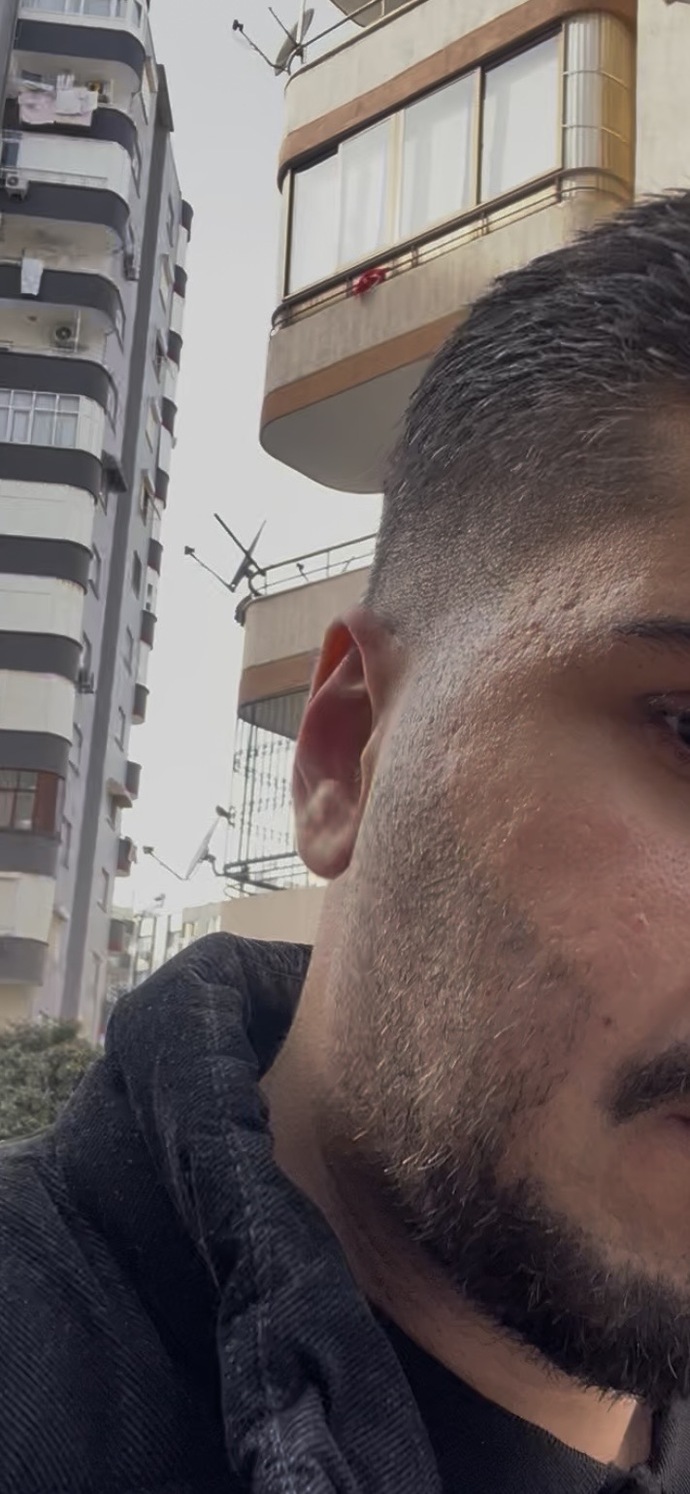 Cildi böyle olan biri eğer yakışıklıysa sevgili olurmuydunuz ya da yakışıklılığını gölgeler mi?
