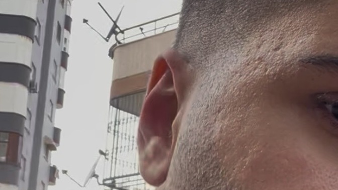 Cildi böyle olan biri eğer yakışıklıysa sevgili olurmuydunuz ya da  yakışıklılığını gölgeler mi?