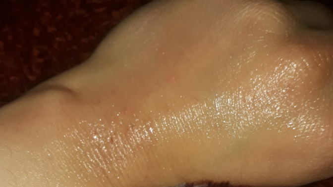 Bir anda çıkan kırmızı cilt lekeleri neden olur, doktora gitmeli miyim?