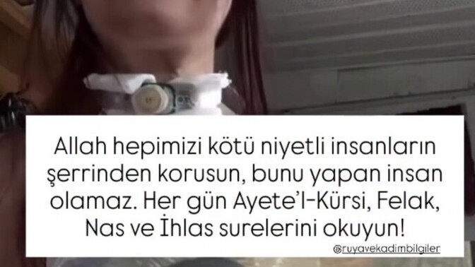 Büyü diye bişey yoksa bu nasıl oldu?