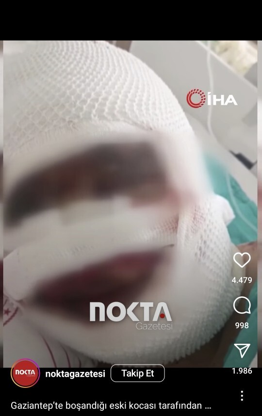Kadının suratı gitmiş mk bu nasıl canilik?