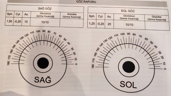 Göz numaralarım ve görme testim bu değerlere göre iyi mi kötü mü 📊?