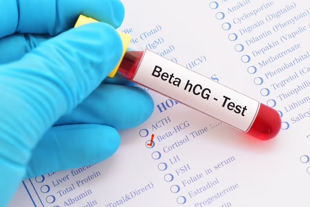 Hiç Beta Hcg baktırdınız mı?