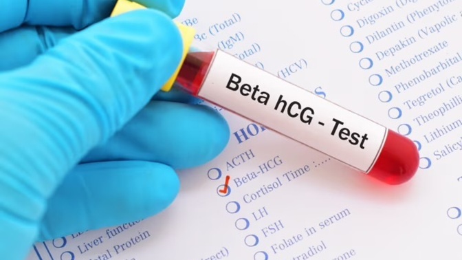 Hiç Beta Hcg baktırdınız mı?