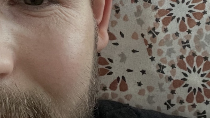 Gülünce oluşan kırışlar botoxla gidiyor mu?