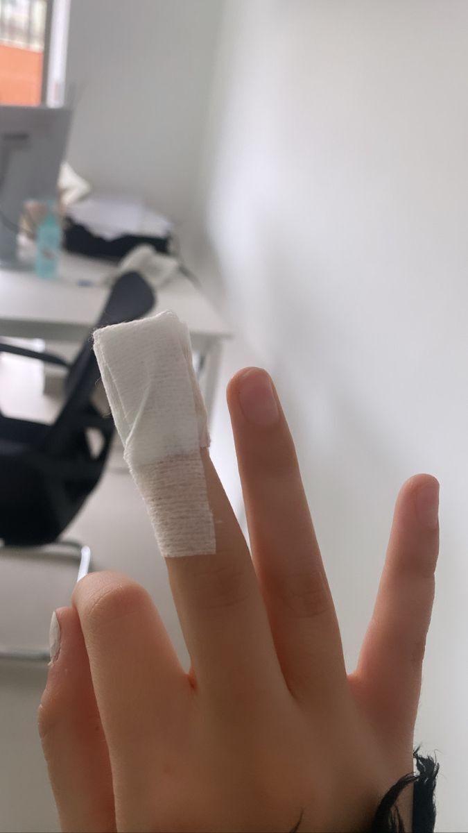 Parmağım kesildi çok acıyor, acısını hemen geçirmek için ne yapabilirim?