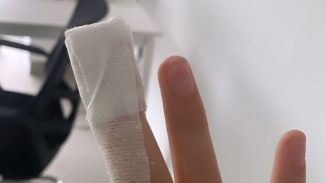 Parmağım kesildi çok acıyor, acısını hemen geçirmek için ne yapabilirim?