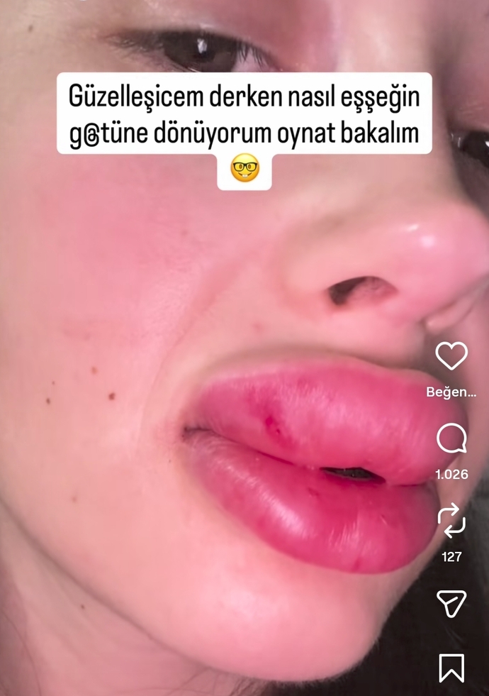 Sizce Hadise estetiği abarttı mı?
