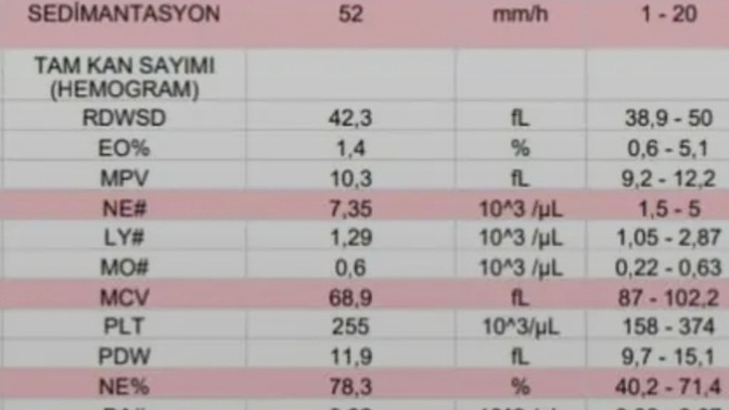 Kan tahlili sonuçlarını nasıl yorumlayabilirim, tahlilden ne anlamalıyım?
