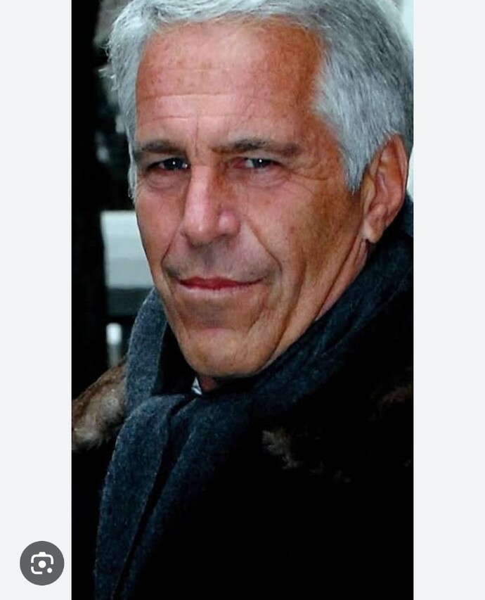 Oe epstein olayı?