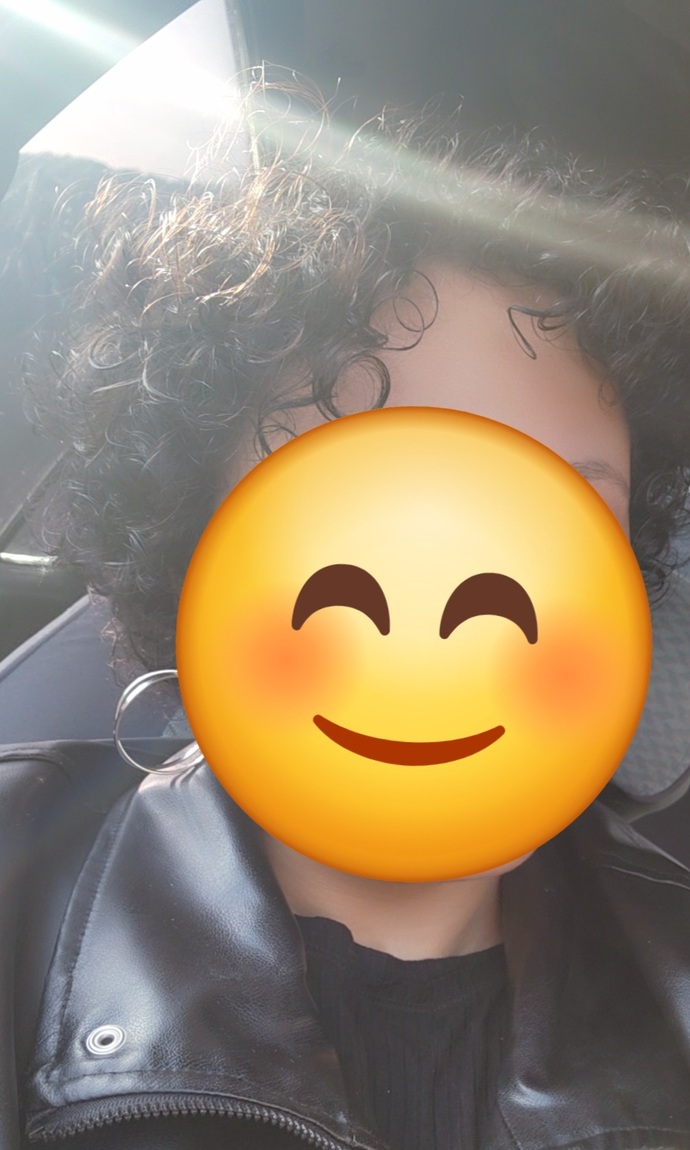 Saçımı kazıtmıştım peruk kullanıyordum şimdi bu kadar uzadı sizce peruğa devam edeyim mi böyle iyi mi?