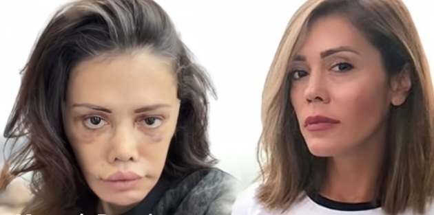 Güney korede estetik ameliyatı olan bu kadının son halini nasıl buldunuz?
