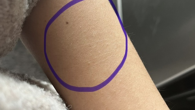 Pomem sağlık mülakatında eski ve belli belirsiz kol izlerinden elenme olur mu?
