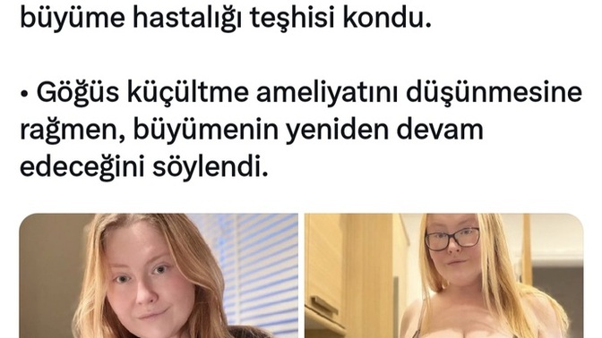 Şu aralar derdin, sıkıntın, kafanı kurcalayan bir şey var mı 😕?