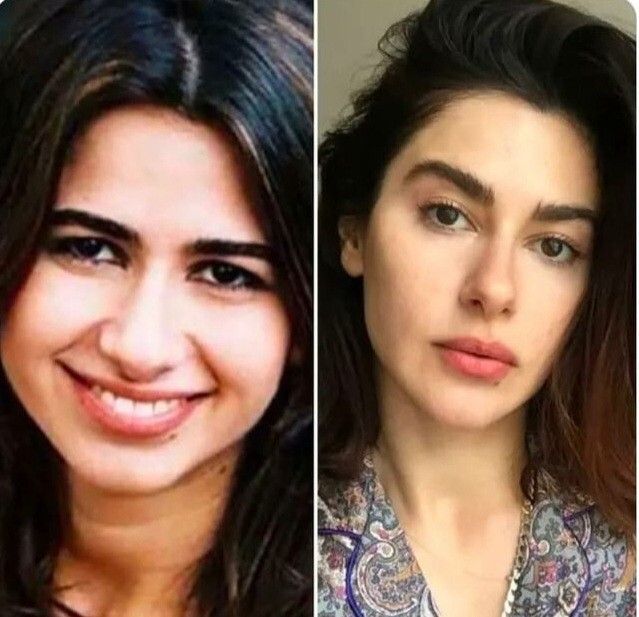 Burnunuz büyük olsaydı estetik yapar mıydınız?