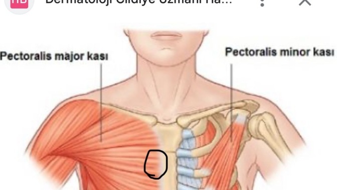 Göğüste bu noktada ağrı?