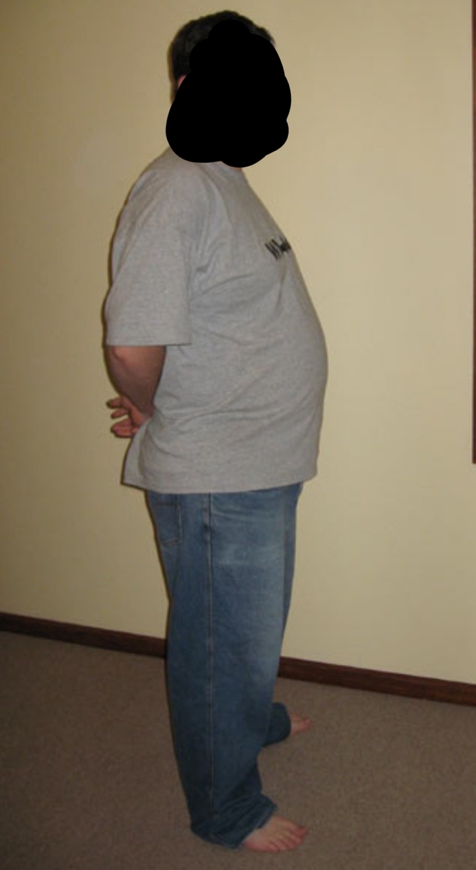 178 boyundayım 104 kg yim dışarıdan cokmu obez görünüyorum?