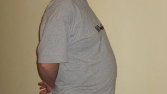 178 boyundayım 104 kg' yim dışarıdan cokmu obez görünüyorum?