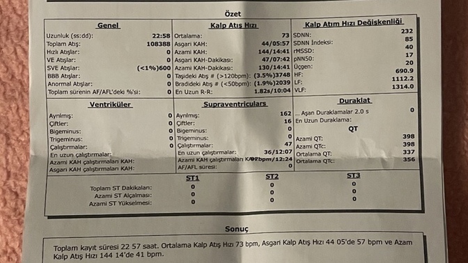 Ritim bozukluğu, çarpıntı ve baş dönmesi şikayetlerinde Holter ne kadar güvenilir sonuç verir?