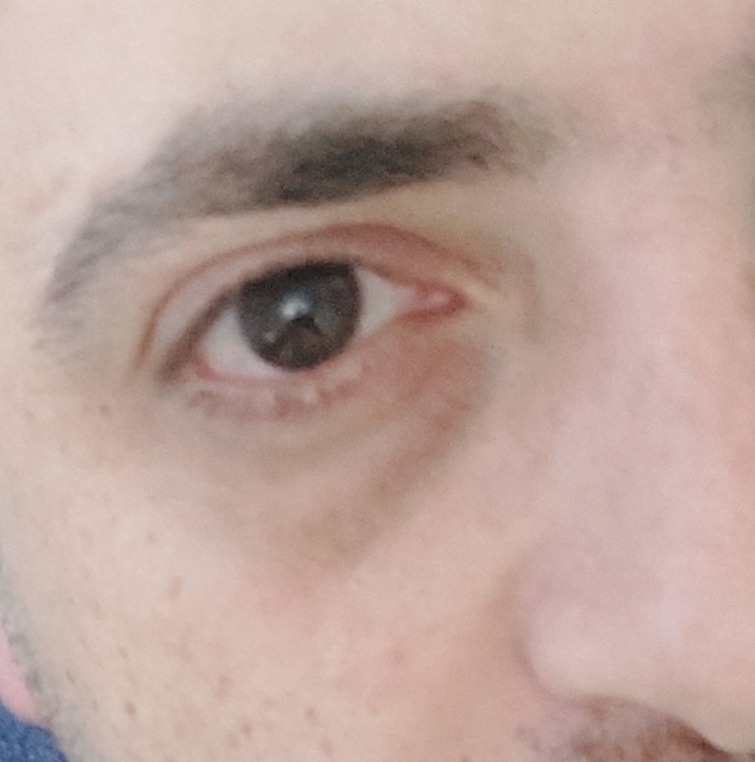 Gözlerinizi begeniyor musunuz?