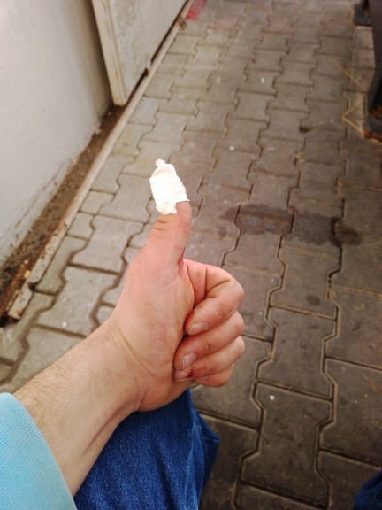 Yaranız var mı?