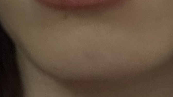 Dudağım ince mi kalin mi?