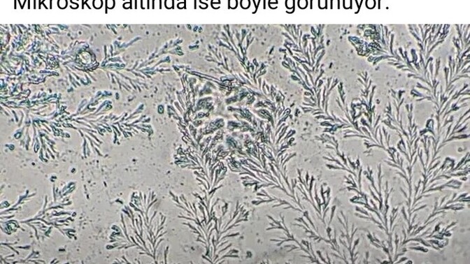Mikroskopla herşeyi incelemeye gerek var mı?