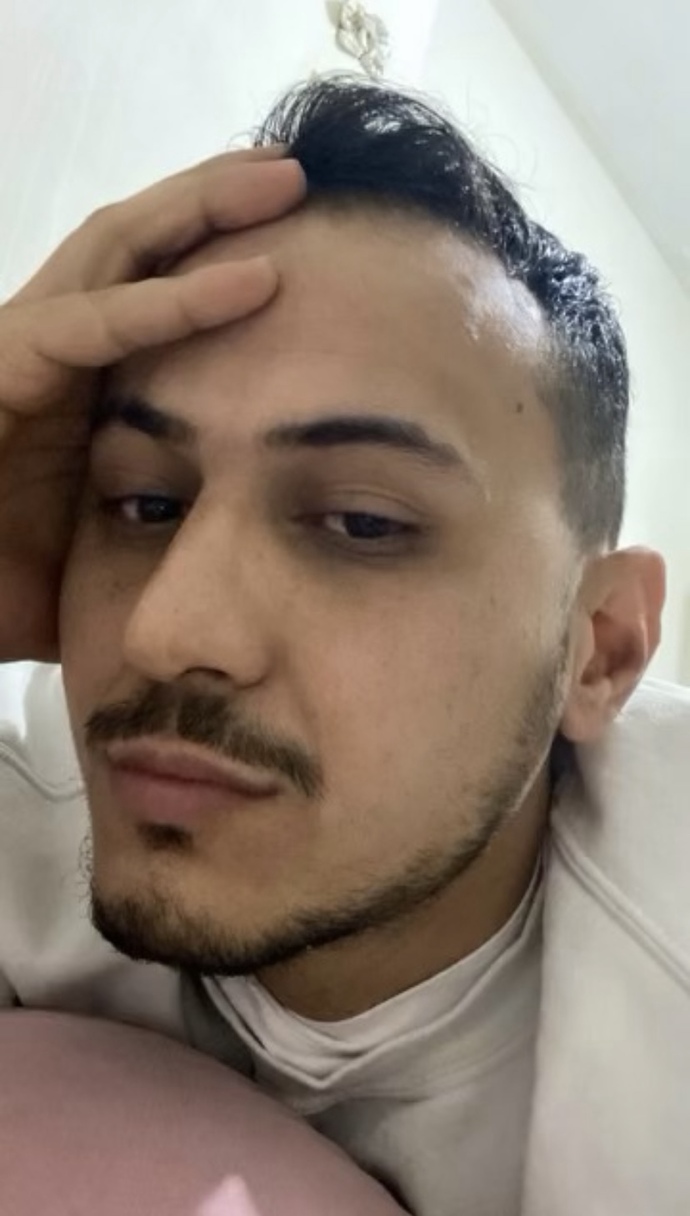 Yüzdeki siyah noktalar?