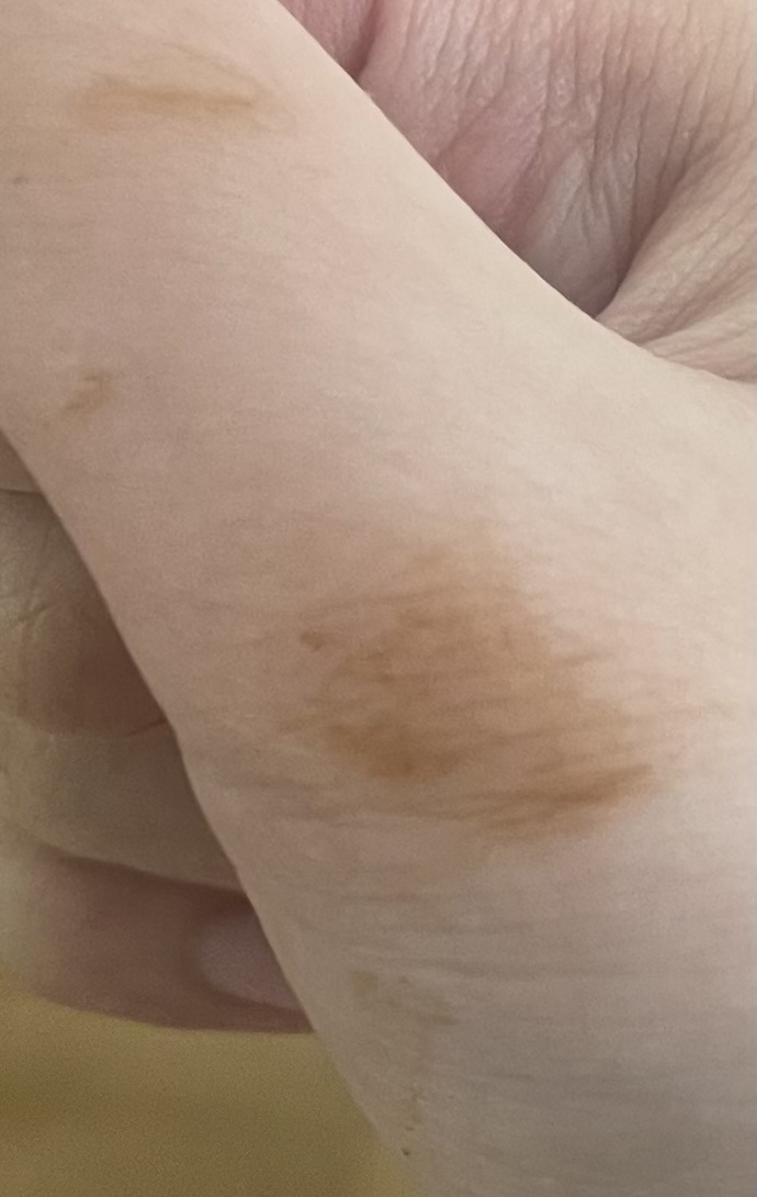 Ben uyurken elime böyle bir şey sürülmüş bu nedir?