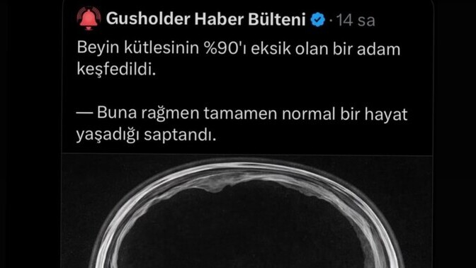 Görseldeki bu adam kim, tanıyan bilen var mı KScanlar?