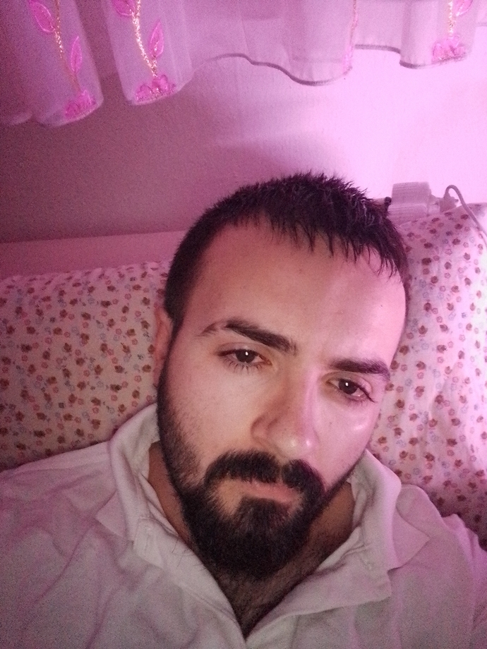 Yüzüm çok şişkin mi duruyo kilo aldım ondanmıdır?