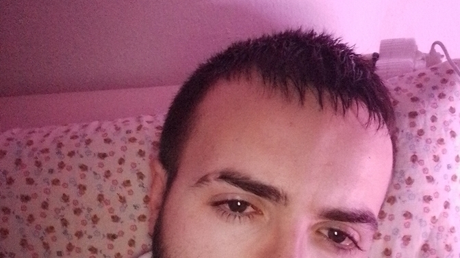 Yüzüm çok şişkin mi duruyo kilo aldım ondanmıdır?