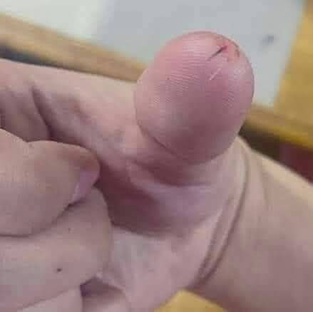 160 boy 75 kilo kız kaç olmalı balıketli olmak için?
