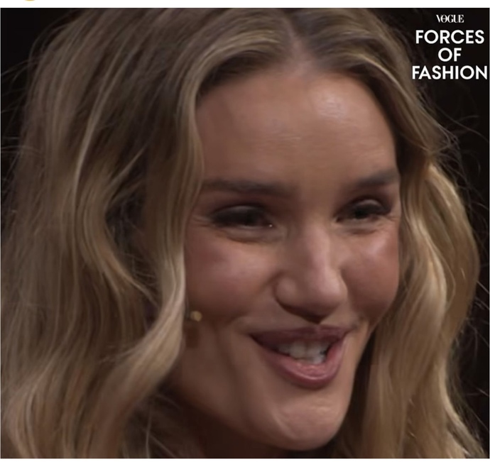 Güzeller güzeli Rosie Huntington-Whiteley estetik kurbanı oldu! Kadınlar neden böyle 😢 ?