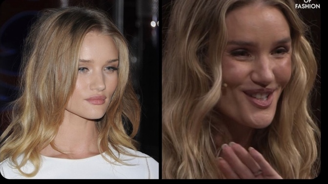 Güzeller güzeli Rosie Huntington-Whiteley estetik kurbanı oldu! Kadınlar neden böyle 😢 ?