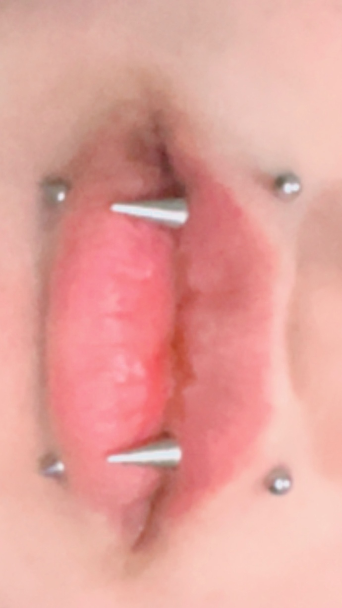 Piercingimde rejection var mı?