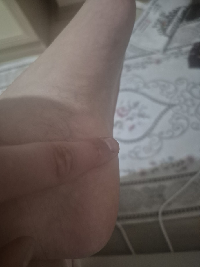 Ayagimin altinda cikan yag bezesi olabilir mi?