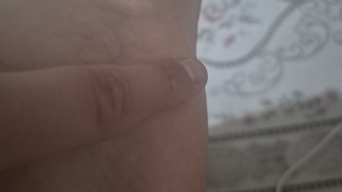 Ayagimin altinda cikan yag bezesi olabilir mi?