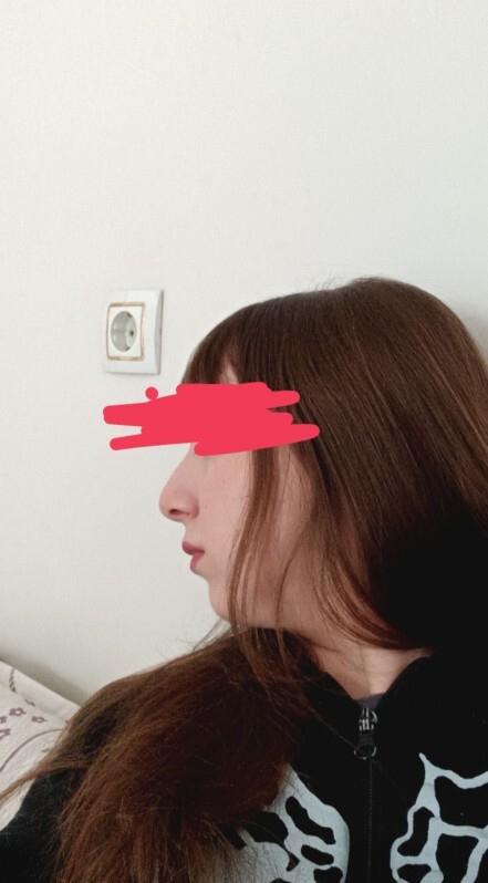 Burnumla ilgili şakalar yapılıyor bense çok kötü olduğunu düşünmüyorum sizce?