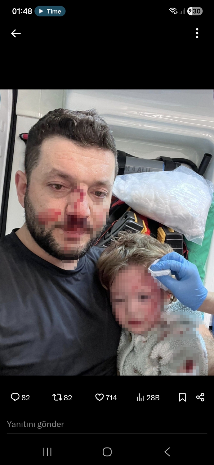 Komşuları bir babayı yanında ki 14 aylık bebeğiyle darp etmişler bu ülkeye ne oldu böyle?