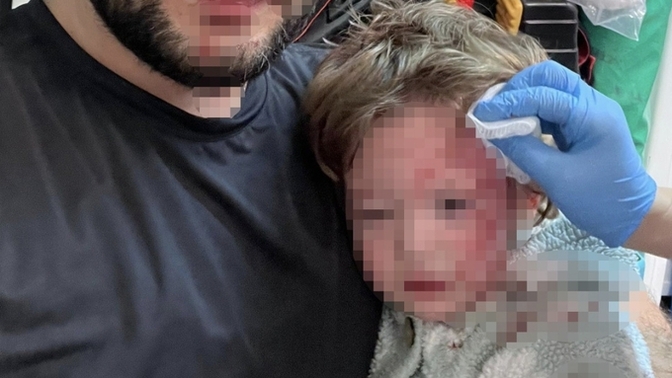 Komşuları bir babayı yanında ki 14 aylık bebeğiyle darp etmişler bu ülkeye ne oldu böyle?